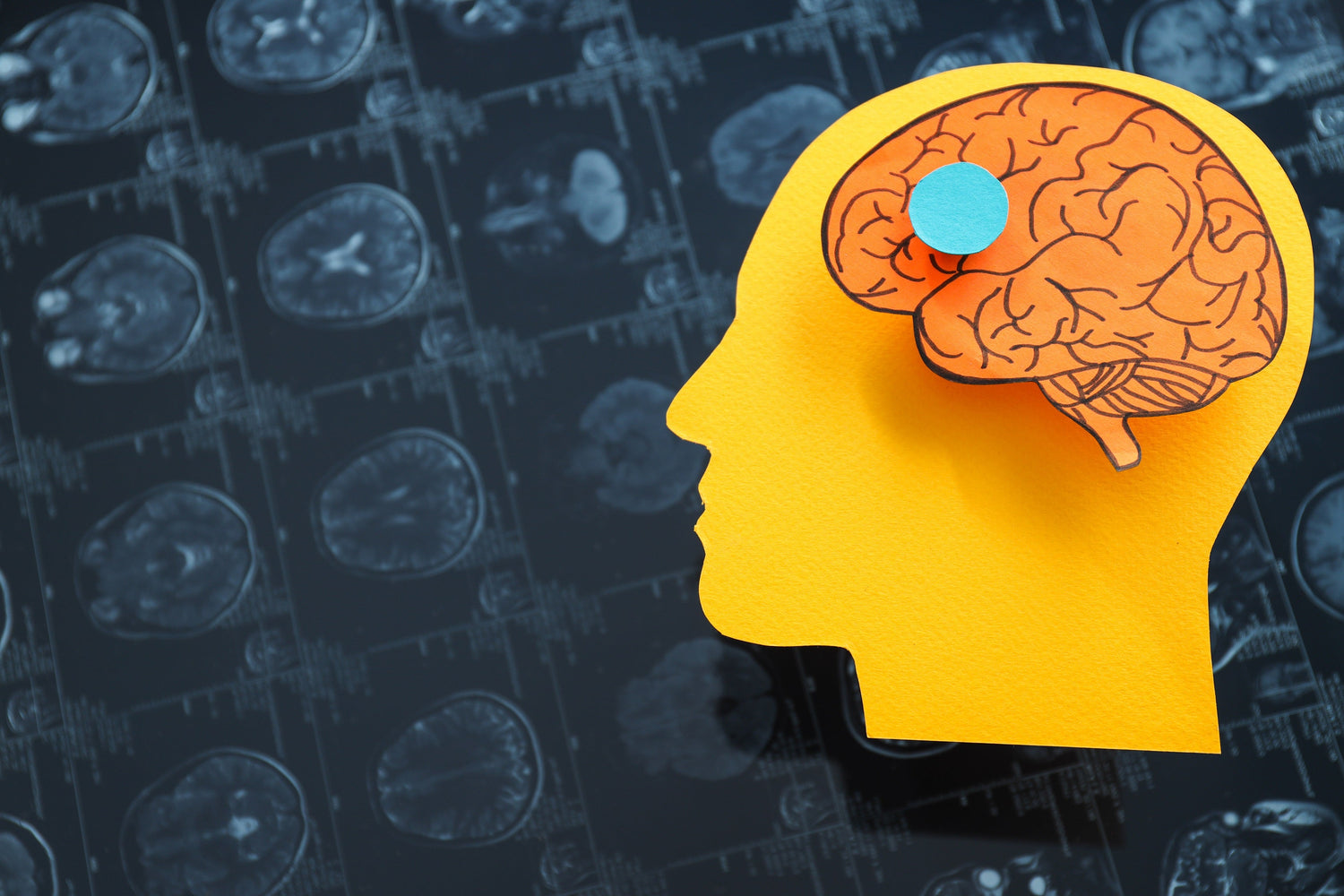 Neuro Supplements